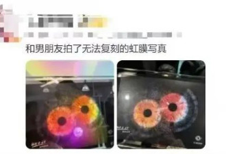 突然走红！有人开始给眼珠拍写真，医生紧急提醒