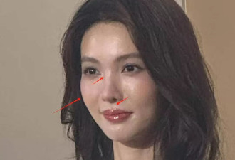 34岁金晨最新生图富态满满，面部又肿又馒