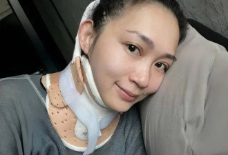 香港知名靓模脖颈严重受伤，玩引体向上凌空坠地，随时可能瘫痪