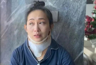 香港知名靓模脖颈严重受伤，玩引体向上凌空坠地，随时可能瘫痪