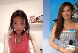豪门婚姻8年噩梦：名模沦为玩物，牙齿全脱落，不足80斤形似骷髅