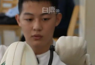 19岁男生被邻居刺伤后脑：目前左侧偏瘫