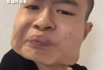 恐怖！河南青年嚼槟榔8年 瓜子脸变四方脸 如海绵宝宝：正在戒