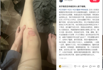 中国女留学生被日本人被推下楼梯 施暴者嘲笑逃跑