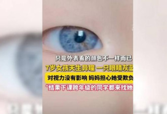 中国7岁女孩“天生异瞳” 1情况快就医