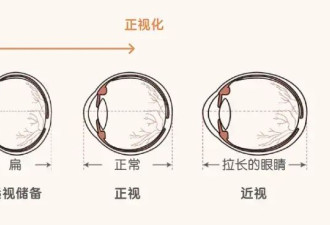 孩子看手机、Pad 超过这个时长真的容易近视