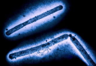 CDC确认 这州出现首例人类感染禽流感重症病例