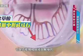 只不过吃了一盘菠菜 竟要终身血透？