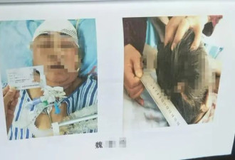 母亲过马路被撞重伤，女儿目睹惨祸应激病倒身亡