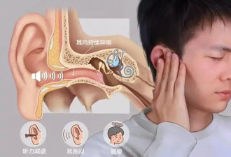 午睡后耳鸣加剧 元凶竟然是打鼾？