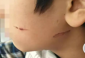 男生遭同学掌掴“一个巴掌赔100元” 校长班主任停职