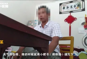 上班6天小伙误触辐射源面临截肢,辐射源有多可怕?