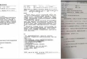 女子术后一年发现应被切除的肺结节还在且已癌变
