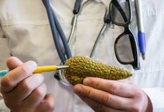 出现这几种症状 警惕胰腺癌！尤其是这类人