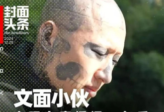 文面小伙决定洗去文身：清洗右眼后，视力下降了