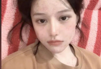 百万粉丝网红“咖啡”去世，年仅29岁！此前自曝患癌决定放弃化疗