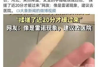 手遇冷后出现这样的变色 千万要小心