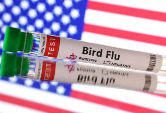 美国累计66人确诊 CDC:密切追踪疫情爆发危险信号