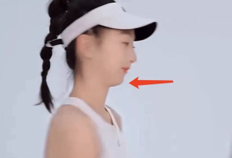 森碟下巴后缩明显错过最佳矫正期，田亮夫妇再遭质疑