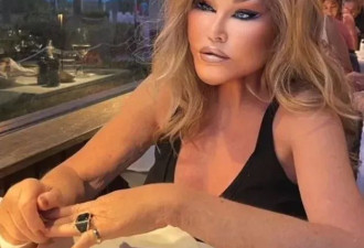 瑞士名媛去世 把自己整成“猫女” 整容前照片曝光