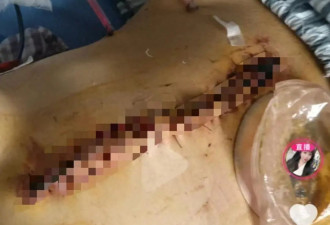 “2年被家暴16次”当事人回应带货：非本意