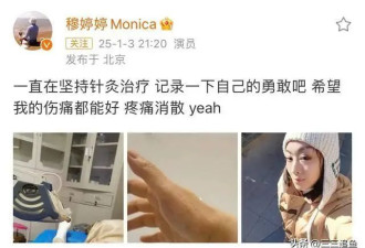 穆婷婷针灸治疗旧伤，身上插近20根长针，痛到把手咬出牙印