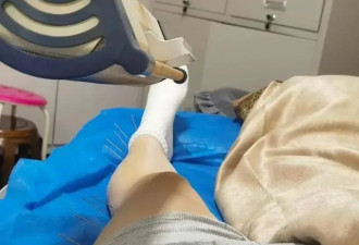 穆婷婷针灸治疗旧伤，身上插近20根长针，痛到把手咬出牙印