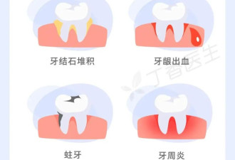 少做1件事 牙齿有一半永远是脏的