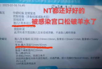 南昌9胞胎女子最后两胎没保住,丈夫:只能保大弃小