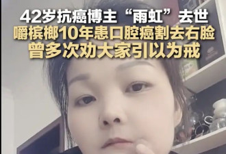 她已离世，年仅42岁！曾手术割去半张脸…
