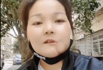 她已离世，年仅42岁！曾手术割去半张脸…
