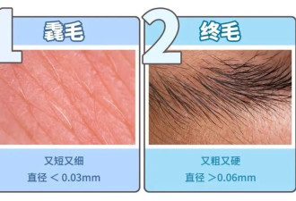 为啥你身上会长几根特别长的毛？