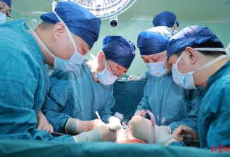 全球首例猪肝植入人体成功,成都企业供基因编辑猪