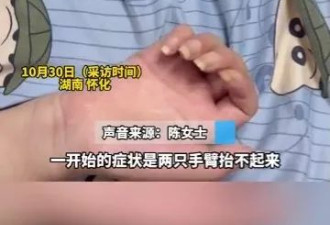 26岁美女确诊渐冻人症 1年间容貌巨变判若两人 曾一度想要轻生