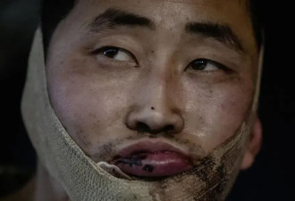 为什么乌克兰活捉一个“棒俘”，会那么难？