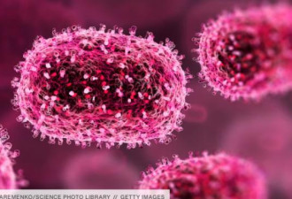 致死率更高 M痘变种病毒在中国首现踪