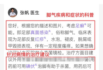 冬天脚后跟干燥脱屑，警惕是脚气！