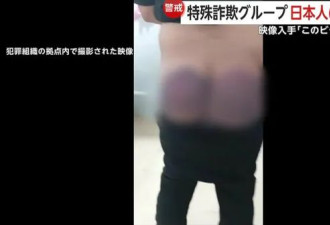 中国科学院博士被骗缅甸：下身被打到黑烂肿胀…