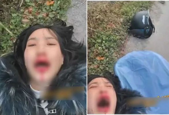 妹子出车祸满脸血！先自拍博关注...夸张画面曝光