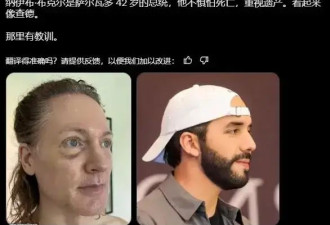 47岁硅谷富豪花几千万变嫩，却变老20岁，面部“姨化”油腻…