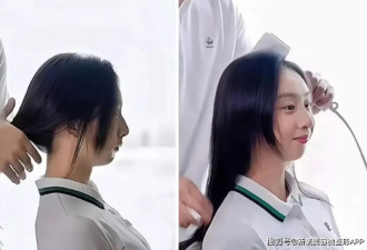 17岁森碟缩到脖子里的下巴，还有机会长出来吗？