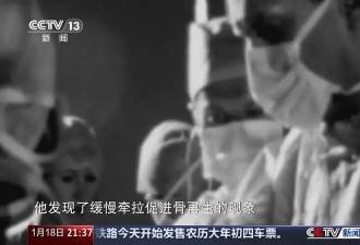 术后麻烦不断 禁而不止的“断骨增高” 有多坑？