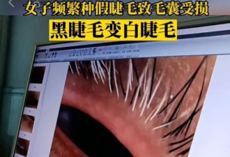 假睫毛暗藏“美丽”隐患 这6点小常识一定要牢记