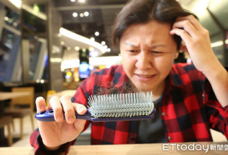 医生点名 9类人最容易掉头发