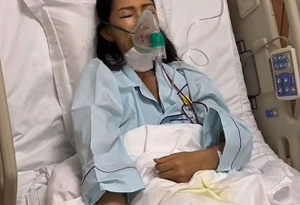 张咪舌癌手术后可以说话了，近照消瘦仍有大舌头