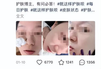 网上爆火的“以油养肤”，真有用还是“智商税”？