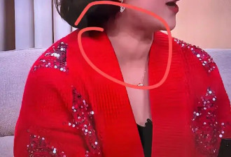 马丽上春晚被网友发现甲状腺有问题 导演组回应小品戛然而止