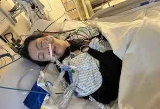 遭严重车祸反复碾压 司机逃逸 华女今面临百万账单