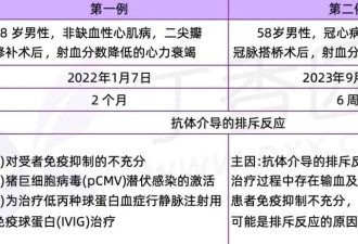 里程碑！接受猪器官移植后 存活时间最久患者来了