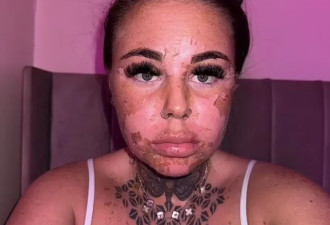 妹子美黑时突发奇想:晒黑咋样? 结果悲剧了